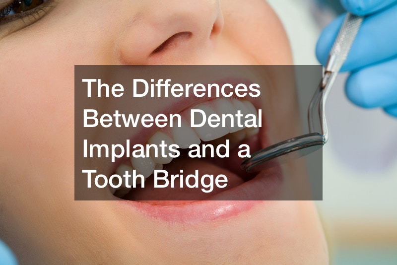 The Differences Between Dental Implants and a Tooth Bridge