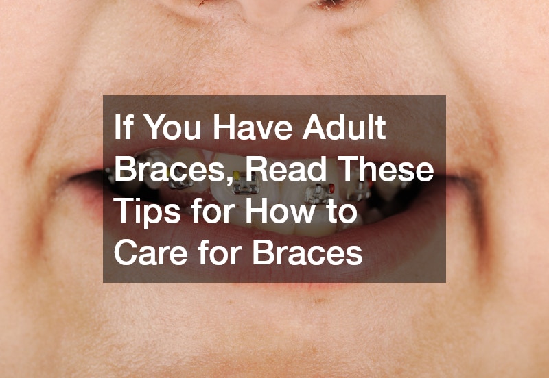 If You Have Adult Braces, Read These Tips for How to Care for Braces