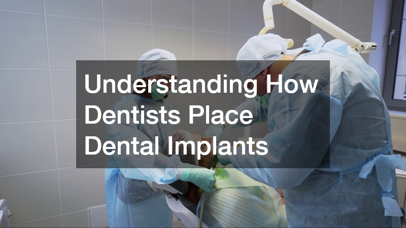 Understanding How Dentists Place Dental Implants